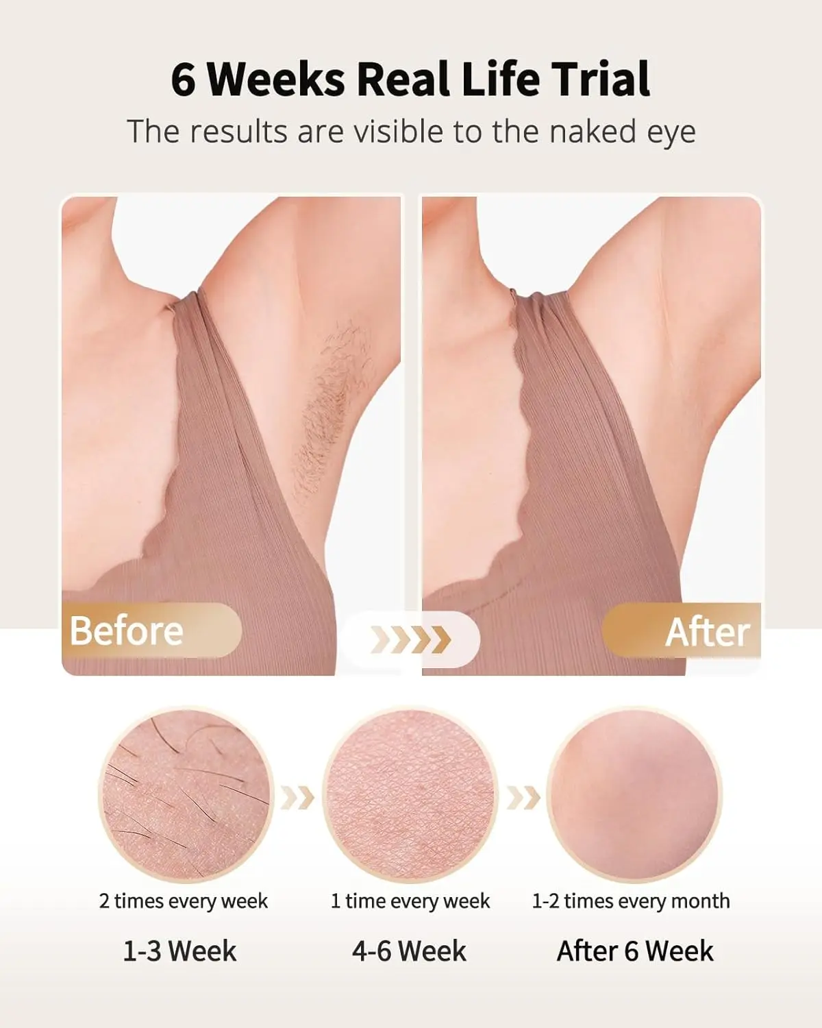 LYSMOSKI IPL Laser Hair Removal Device con Ice Cooling - Imagen 4