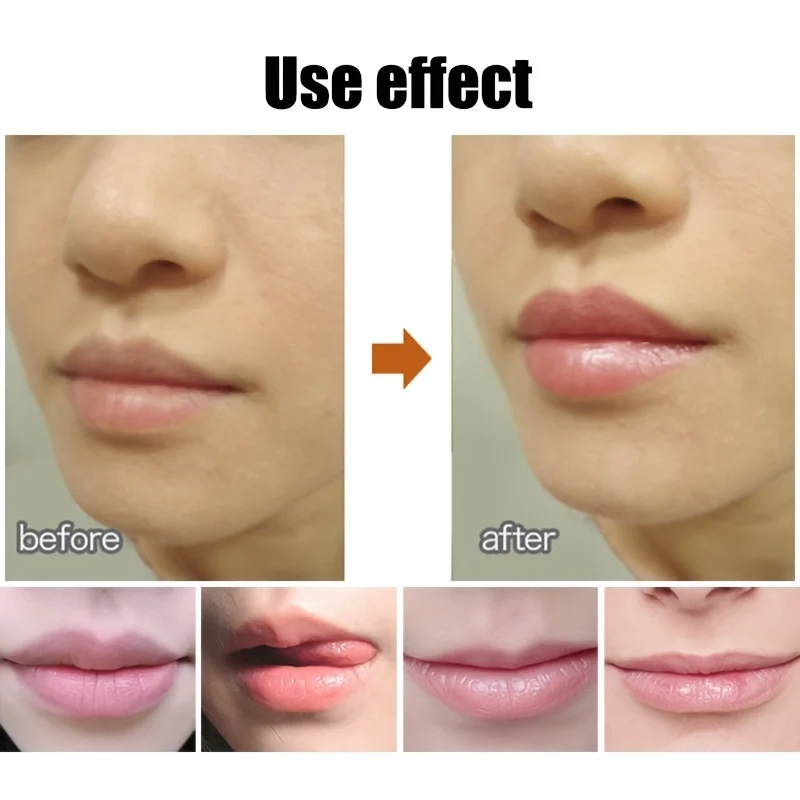 Bálsamo labial en formato bola - Imagen 4