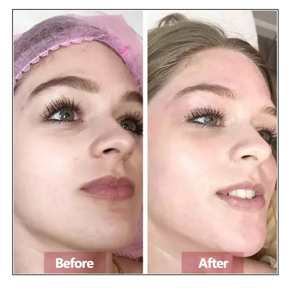 Sérum Facial con Ácido Hialurónico - Imagen 3