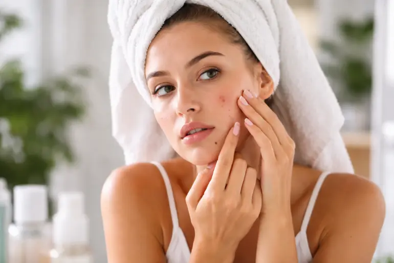 Qué hacer cuando te sale un brote por usar un producto nuevo