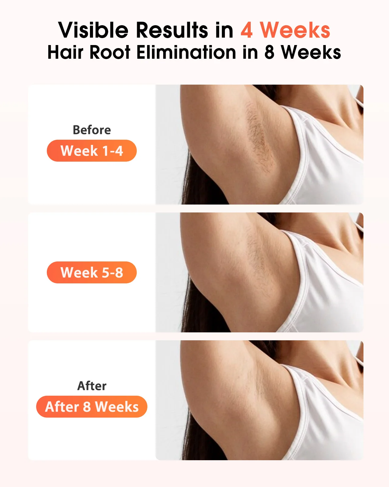 LYSMOSKI IPL Hair Removal Device - Imagen 3